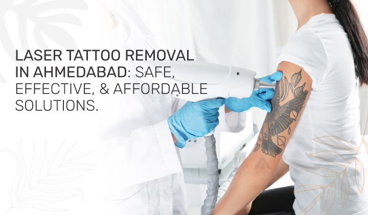 How Can I Remove My Permanent Tattoo Without Laser?